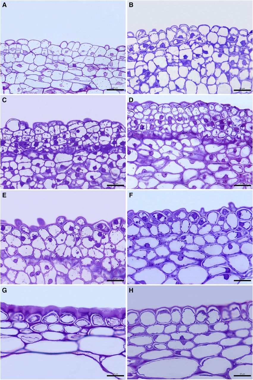 Cutin Synthesis And Deposition Plantae