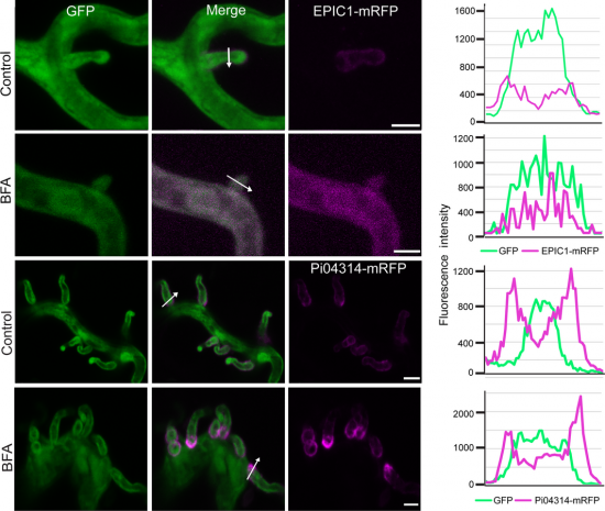 Special delivery: An independent secretion pathway for the delivery of ...