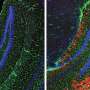 Ubiquitin marks abnorm