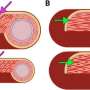 Researchers achieve ke